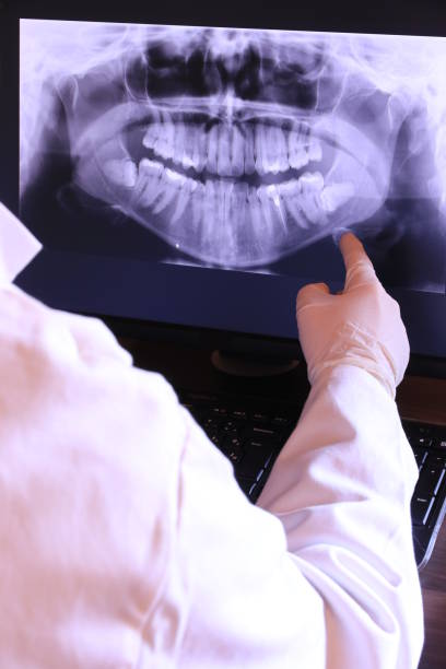 Best Urgent Care for Lost Fillings or Crowns in Bonnie Brae, IL